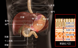 胃がん画像