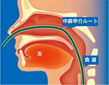 経鼻検査2