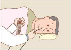 経鼻検査1