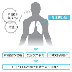 慢性閉塞性疾患COPD01